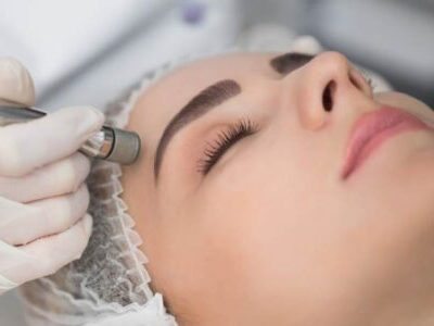 Microdermabrasion facial