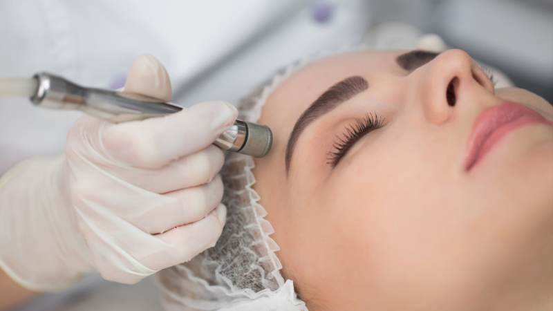 Microdermabrasion facial